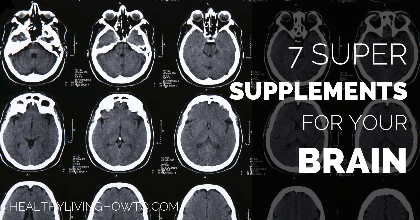 7 Super Supplements for Your Brain | healtylivinghowto.com